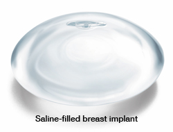 Nac Ratio Breast Lift Vs Breast Augmentation 6